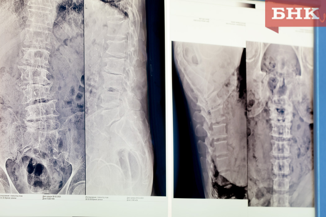 В Минздраве Коми оценили затраты на покупку и ремонт ломающихся рентгенов